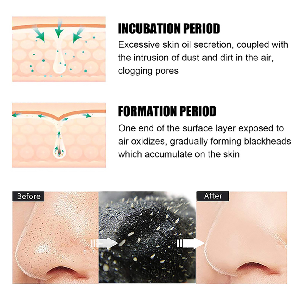 แผ่นลอกสิวเสี้ยนทำความสะอาดรูข - Charcoal Pore Strip บทวิจารณ์และราคา