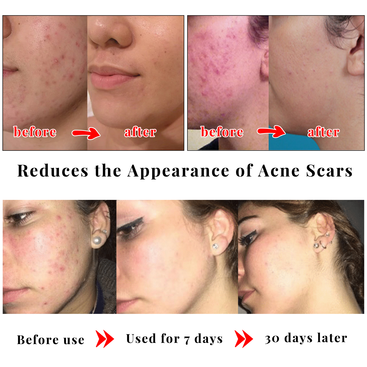 โคจิก แอซิด โกลว์ โซป สบู่ทำคว - Skincare X2 บทวิจารณ์และราคา