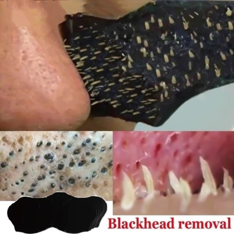 แผ่นติดจมูกสำหรับกำจัดสิวหัวดำ - Charcoal Pore Strip บทวิจารณ์และราคา