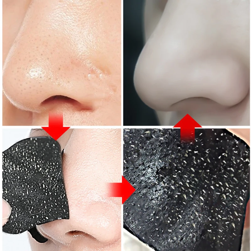 แผ่นติดจมูกสำหรับกำจัดสิวหัวดำ - Charcoal Pore Strip บทวิจารณ์และราคา