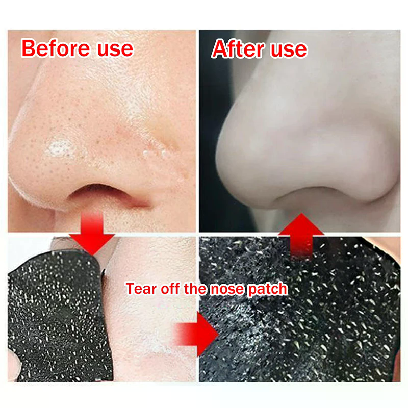 แผ่นลอกสิวเสี้ยนจากถ่านไม้ไผ่  - Charcoal Pore Strip บทวิจารณ์และราคา