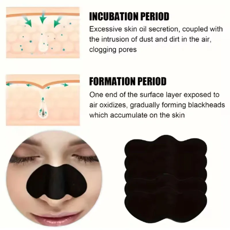 แผ่นลอกสิวเสี้ยนสีดำ 10/20/50  - Charcoal Pore Strip บทวิจารณ์และราคา